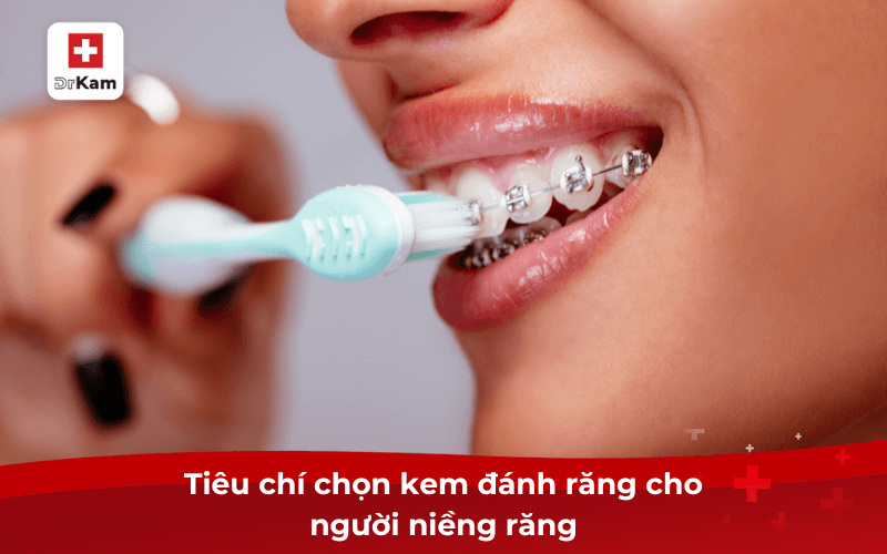 TOP 10 kem đánh răng cho người niềng hiệu quả bác sĩ khuyên dùng 10 Tiêu chí chọn kem đánh răng cho người niềng răng