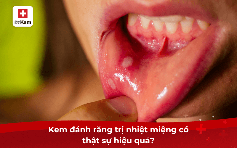 Top 5 kem đánh răng trị nhiệt miệng tốt nhất hiện nay được bác sĩ khuyên dùng 7 Kem đánh răng trị nhiệt miệng có thật sự hiệu quả?