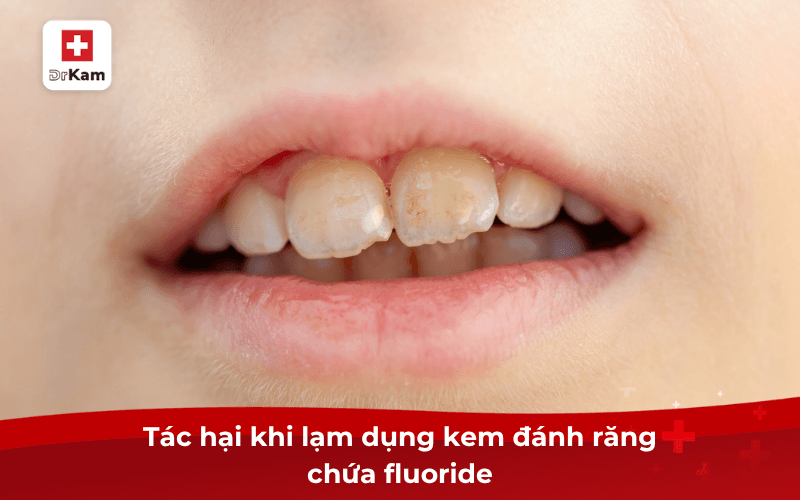 Chọn kem đánh răng sinh học không chứa fluoride cho trẻ em 7 Tác hại khi lạm dụng kem đánh răng chứa fluoride