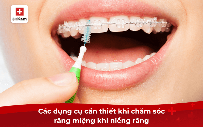 Các bước chăm sóc răng miệng khi niềng răng như thế nào? 7 Các dụng cụ cần thiết khi chăm sóc răng miệng khi niềng răng