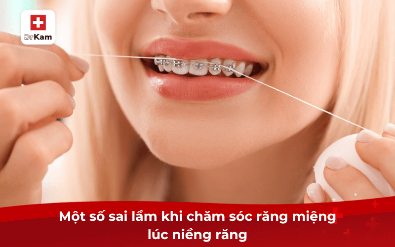 Các bước chăm sóc răng miệng khi niềng răng như thế nào? 9 Một số sai lầm khi chăm sóc răng miệng lúc niềng răng