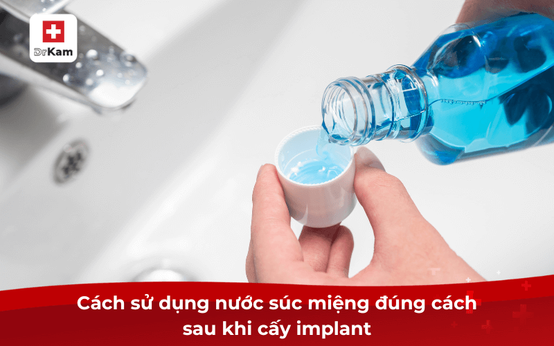 Nước súc miệng sau khi cắm implant được bác sĩ khuyên dùng? Cách chọn và lưu ý 6 Cách sử dụng nước súc miệng đúng cách sau khi cấy implant