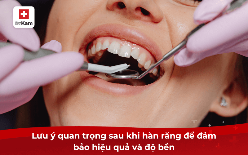 Lưu ý quan trọng sau khi hàn răng để đảm bảo hiệu quả và độ bền