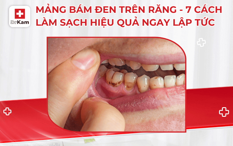 mang bam den tren rang