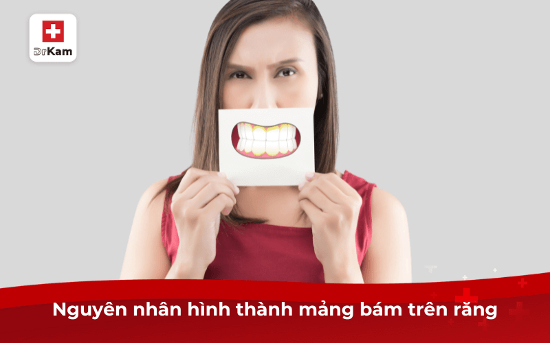 Mảng bám răng có hại không? Quá trình hình thành, nguyên nhân và cách loại bỏ hiệu quả 7 Nguyên nhân hình thành mảng bám trên răng