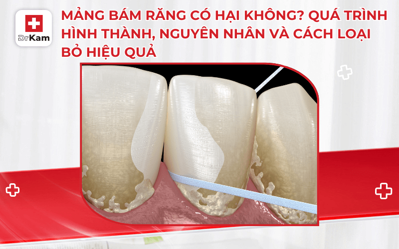 mang bam rang