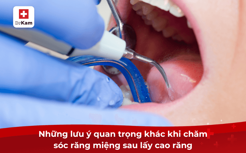 Những lưu ý quan trọng khác khi chăm sóc răng miệng sau lấy cao răng
