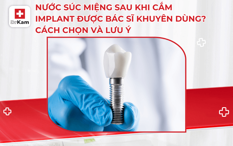 nuoc suc mieng sau khi cam implant cach chon va luu y