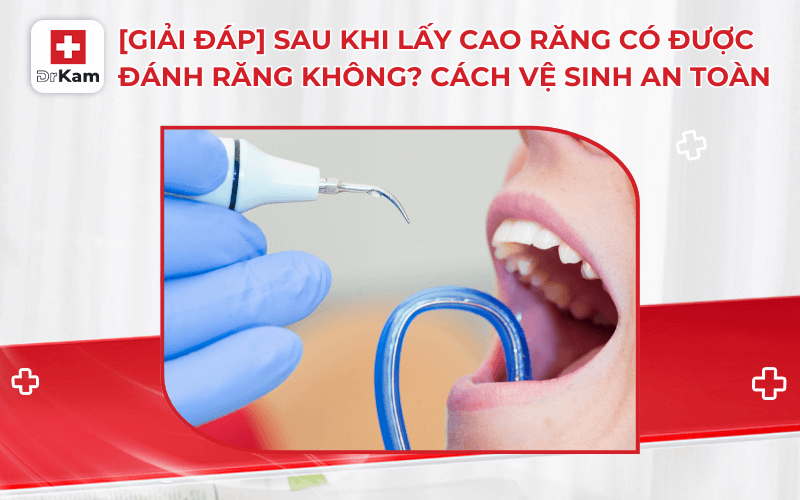 sau khi lay cao rang co duoc danh rang khong