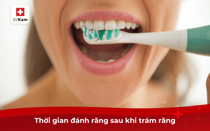 Thời gian đánh răng sau khi trám răng