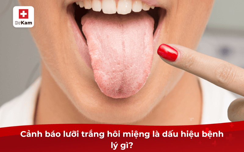 Cảnh báo lưỡi trắng hôi miệng là dấu hiệu bệnh lý gì?