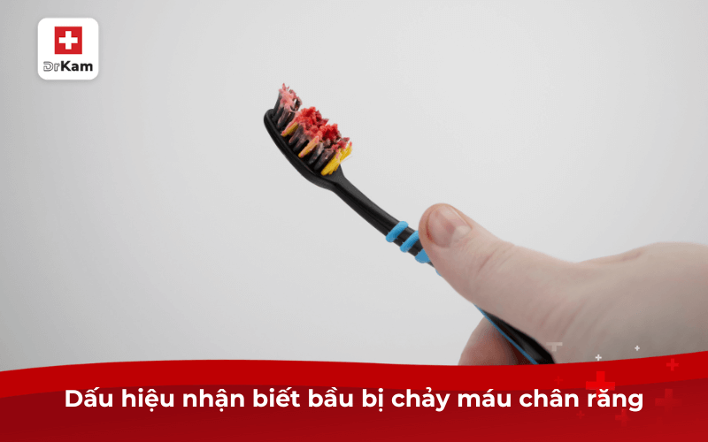 Bầu bị chảy máu chân răng: 4 biến chứng và cách điều trị, chăm sóc mẹ bầu cần biết 5 Dấu hiệu nhận biết bầu bị chảy máu chân răng