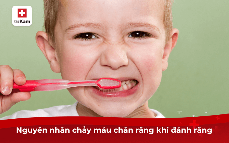 Nguyên nhân chảy máu chân răng khi đánh răng