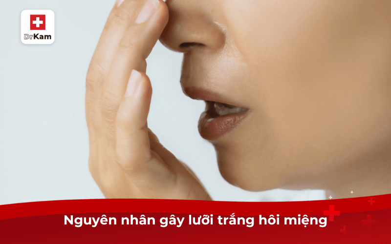 Nguyên nhân gây lưỡi trắng hôi miệng