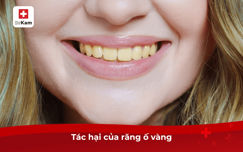 Răng ố vàng: 10 nguyên nhân, tác hại và cách khắc phục hiệu quả 6 Tác hại của răng ố vàng