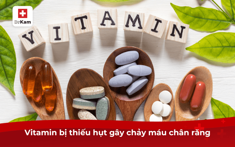 Bị chảy máu chân răng là thiếu chất gì?