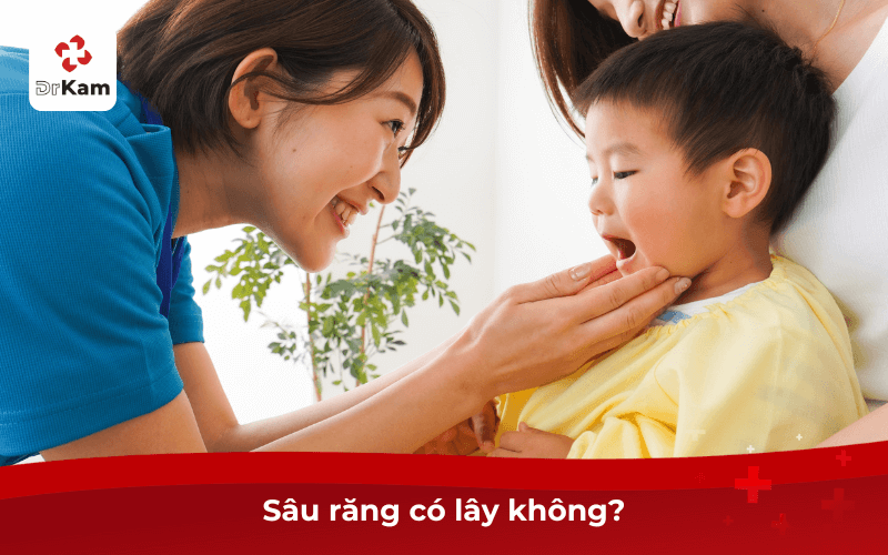 Sâu răng có lây không?