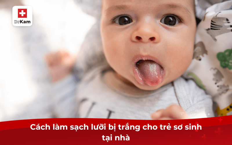 Cách làm sạch lưỡi bị trắng cho trẻ sơ sinh tại nhà