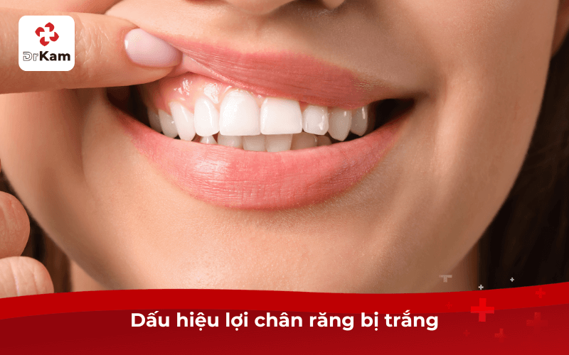 Dấu hiệu lợi chân răng bị trắng