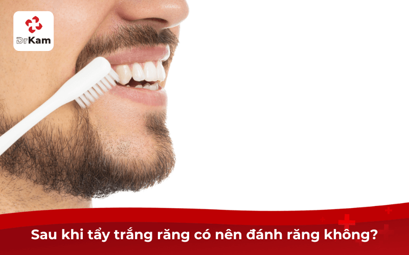 Sau khi tẩy trắng răng có nên đánh răng không?