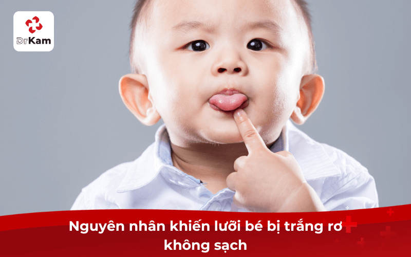Lưỡi bé bị trắng rơ không sạch? Cách vệ sinh và phòng ngừa đúng cách 4 Nguyên nhân khiến lưỡi bé bị trắng rơ không sạch