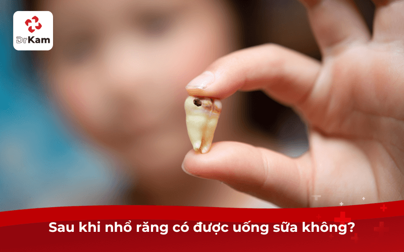 Sau khi nhổ răng có được uống sữa không?