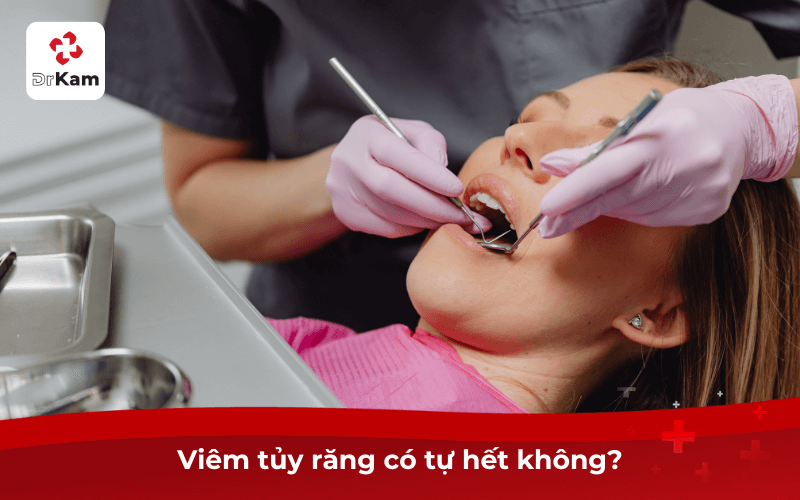Viêm tủy răng có tự hết không?
