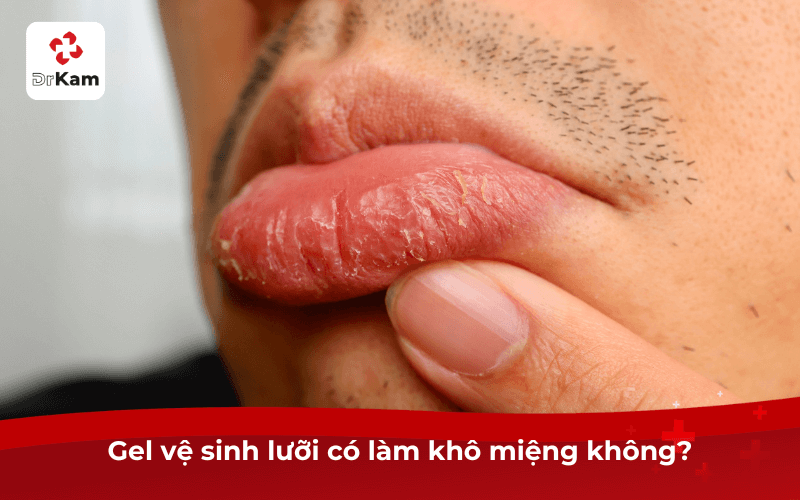 Gel vệ sinh lưỡi có làm khô miệng không?