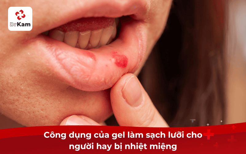 Công dụng của gel làm sạch lưỡi cho người hay bị nhiệt miệng