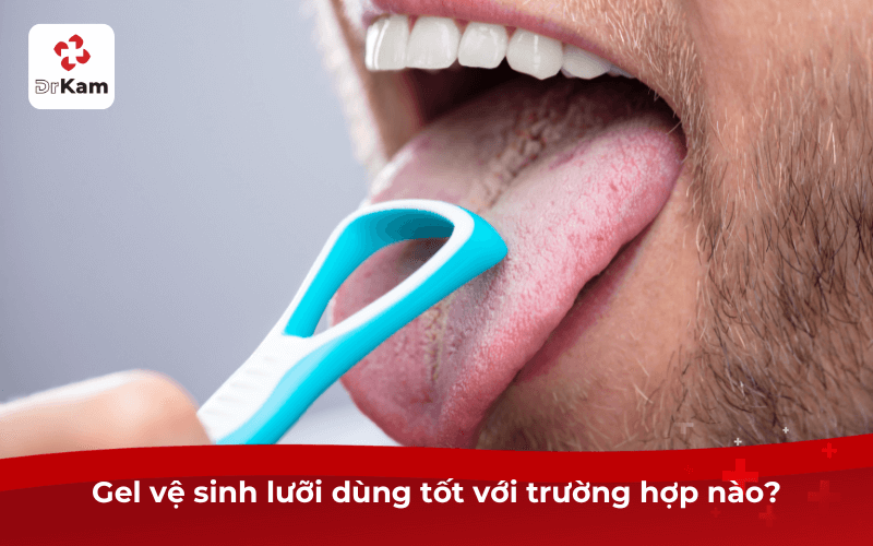 Gel vệ sinh lưỡi có tốt không? 5 ưu điểm nổi bật nên dùng ngay sạch lưỡi 6 Gel vệ sinh lưỡi dùng tốt với trường hợp nào?