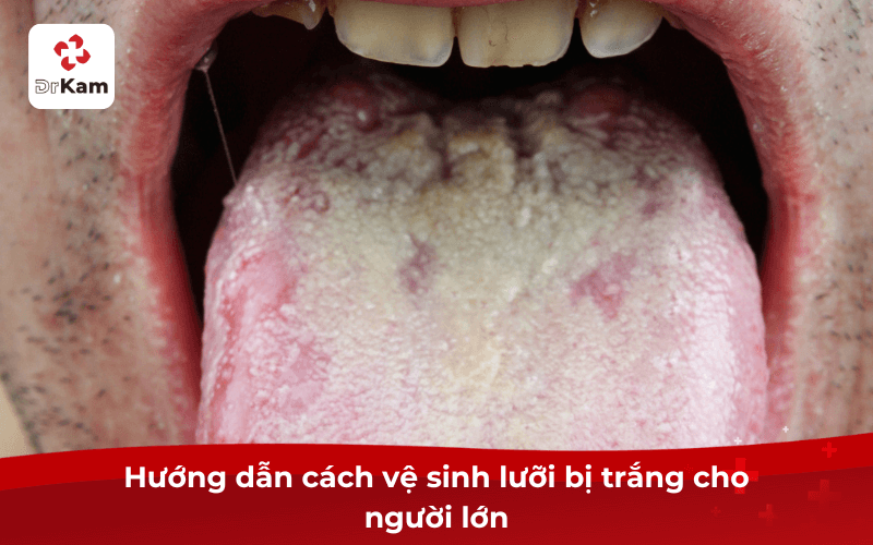 11 Cách vệ sinh lưỡi đúng cách hiệu quả giúp thơm miệng, sạch lưỡi tại nhà cho người lớn và trẻ em 6 Hướng dẫn cách vệ sinh lưỡi bị trắng cho người lớn