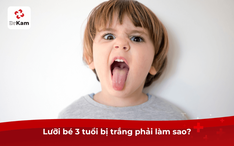 Lưỡi bé 3 tuổi bị trắng phải làm sao?