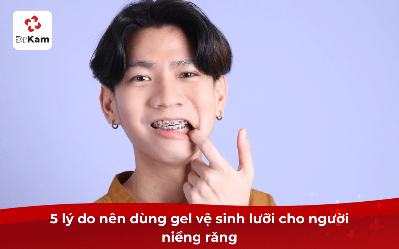 5 lý do nên dùng gel vệ sinh lưỡi cho người niềng răng
