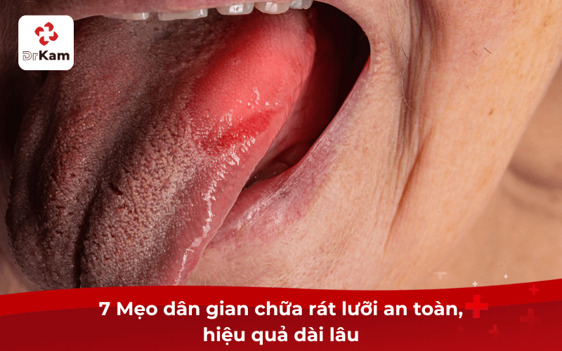 12+ Mẹo Chữa Rát Lưỡi Tại Nhà Nhanh Khỏi & Phác Đồ Dinh Dưỡng 6 7 Mẹo dân gian chữa rát lưỡi an toàn, hiệu quả dài lâu