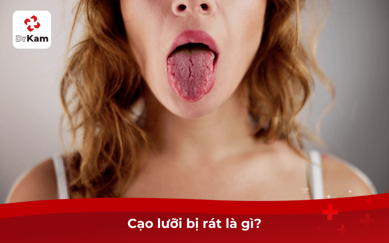 Cạo lưỡi bị rát là gì?
