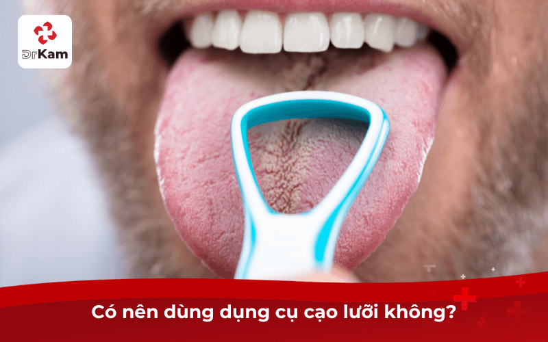 Có nên dùng dụng cụ cạo lưỡi không?