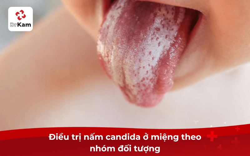 10+ Cách trị nấm candida ở miệng an toàn và hiệu quả nên áp dụng ngay 6 Điều trị nấm candida ở miệng theo nhóm đối tượng