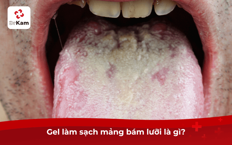 Gel làm sạch mảng bám lưỡi là gì?