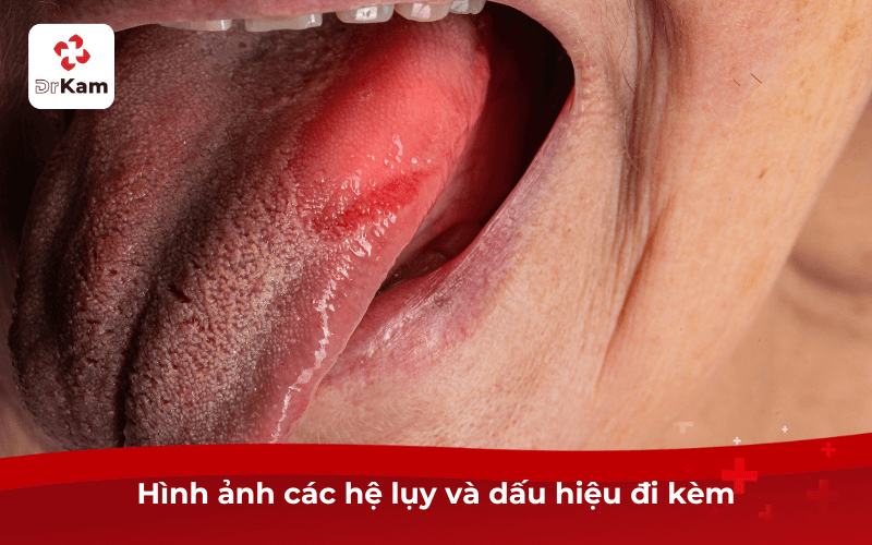 Hình ảnh các hệ lụy và dấu hiệu đi kèm