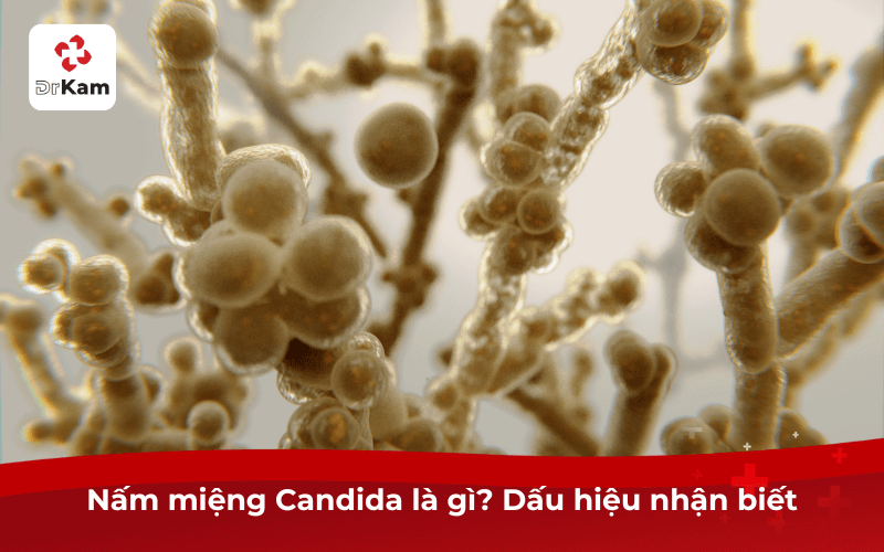 Nấm miệng Candida là gì? Triệu chứng, nguyên nhân và cách điều trị phòng ngừa 5 Nấm miệng Candida là gì? Dấu hiệu nhận biết
