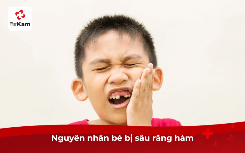 Nguyên nhân bé bị sâu răng hàm