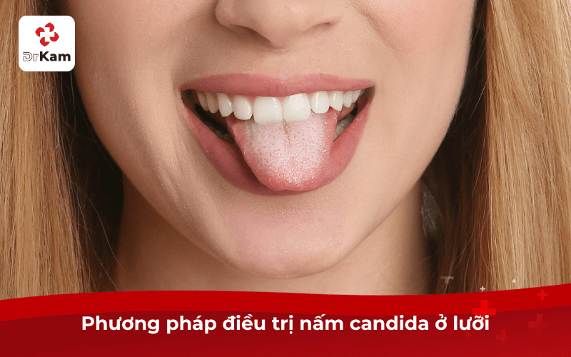 Nấm candida ở lưỡi là gì? Hình ảnh, dấu hiệu, triệu chứng và phương pháp điều trị hiệu quả 6 Phương pháp điều trị nấm candida ở lưỡi
