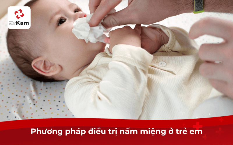 Phương pháp điều trị nấm miệng ở trẻ em