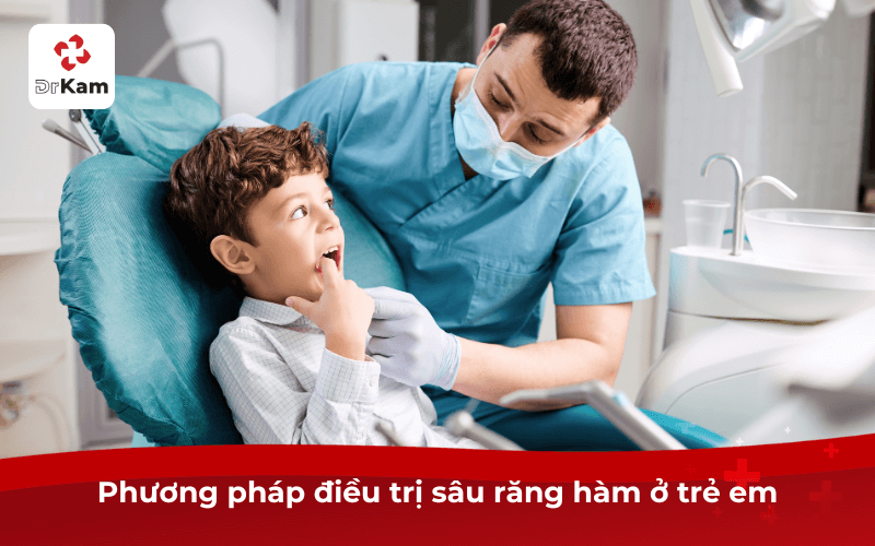 Phương pháp điều trị sâu răng hàm ở trẻ em