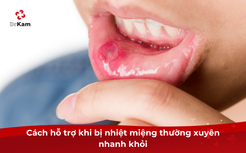 Cách hỗ trợ khi bị nhiệt miệng thường xuyên nhanh khỏi