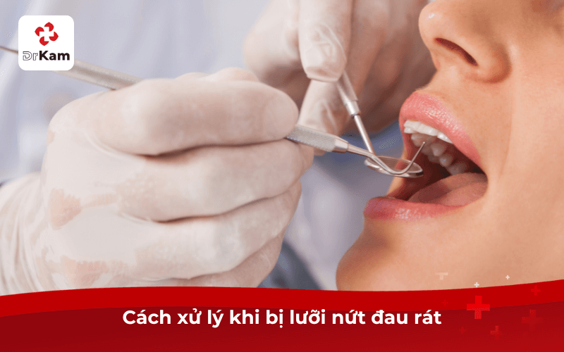 Cách xử lý khi bị lưỡi nứt đau rát