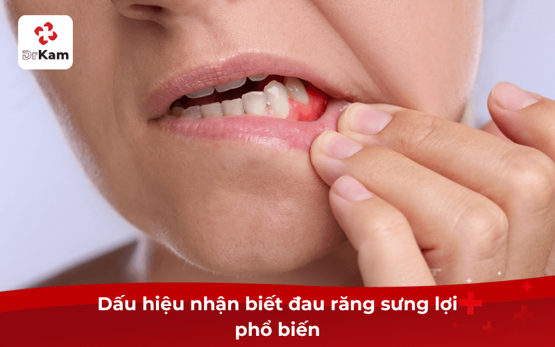 Dấu hiệu nhận biết đau răng sưng lợi phổ biến