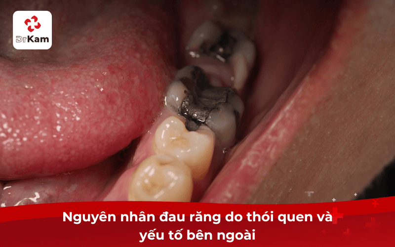 5 Nguyên nhân đau răng cần biết điều trị kịp thời tránh hậu quả nghiêm trọng 4 Nguyên nhân đau răng do thói quen và yếu tố bên ngoài