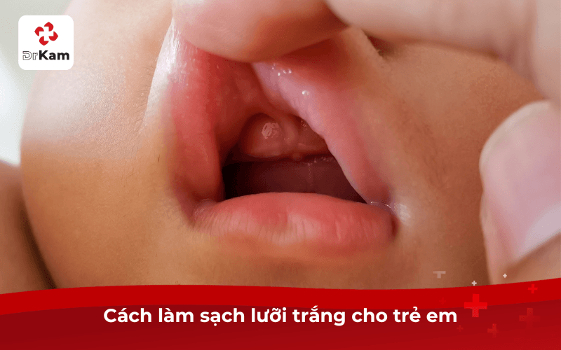 4 Cách làm sạch lưỡi trắng cho người lớn và trẻ em an toàn và hiệu quả 4 Cách làm sạch lưỡi trắng cho trẻ em