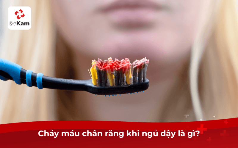 Chảy máu chân răng khi ngủ dậy - Nguyên nhân và cách khắc phục hiệu quả 4 Chảy máu chân răng khi ngủ dậy là gì?